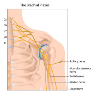 Brachial Plexopathy Testing in California - Precision Medical Group